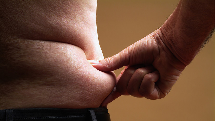 абдоминальный тип ожирения у мужчин